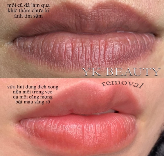HÚT DUNG DỊCH NỀN CŨ